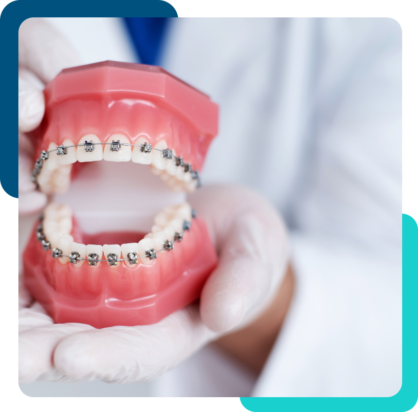 dentist holding model teeth with traditional braces