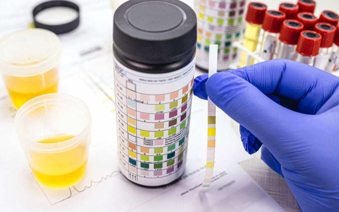 Navigating ISNetworld Drug Testing Requirements